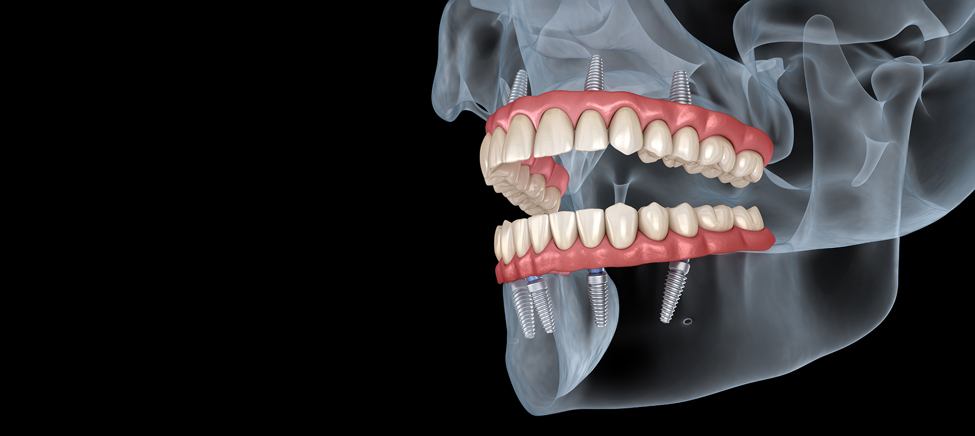 Kramer and Kramer Dental | Laser Dentistry, Veneers and Digital Radiography