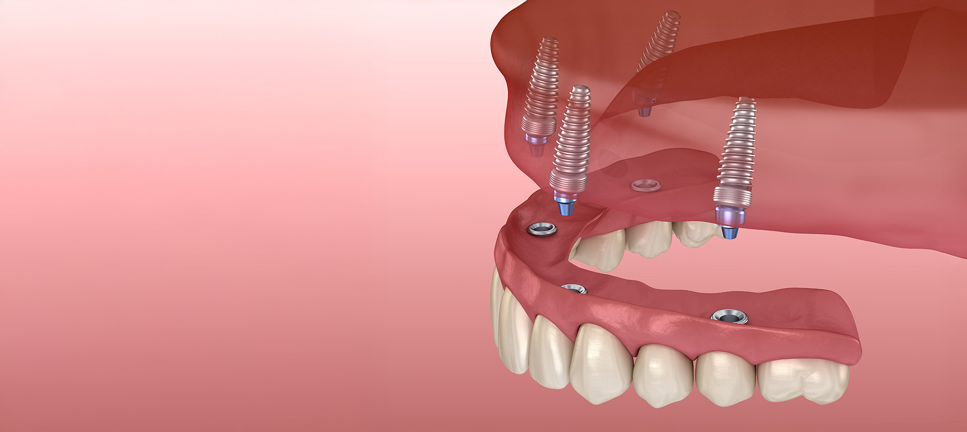 Kramer and Kramer Dental | Cosmetic Dentistry, Dental Fillings and Digital Radiography