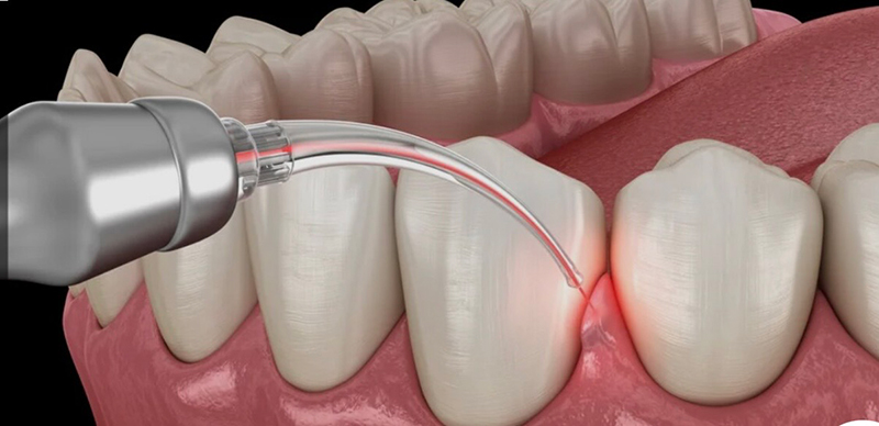 Kramer and Kramer Dental | Night Guards, Dentures and Oral Exams