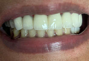 Kramer and Kramer Dental | Cosmetic Dentistry, Dental Videos and Oral Exams