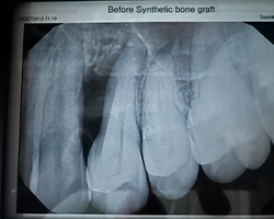 Kramer and Kramer Dental | Periodontal Treatment, Root Canals and All-on-4 reg